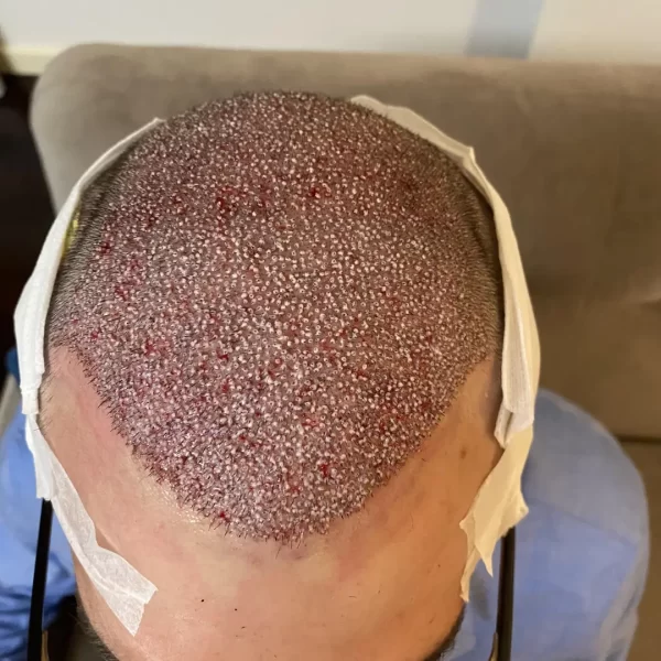 controllo post operatorio